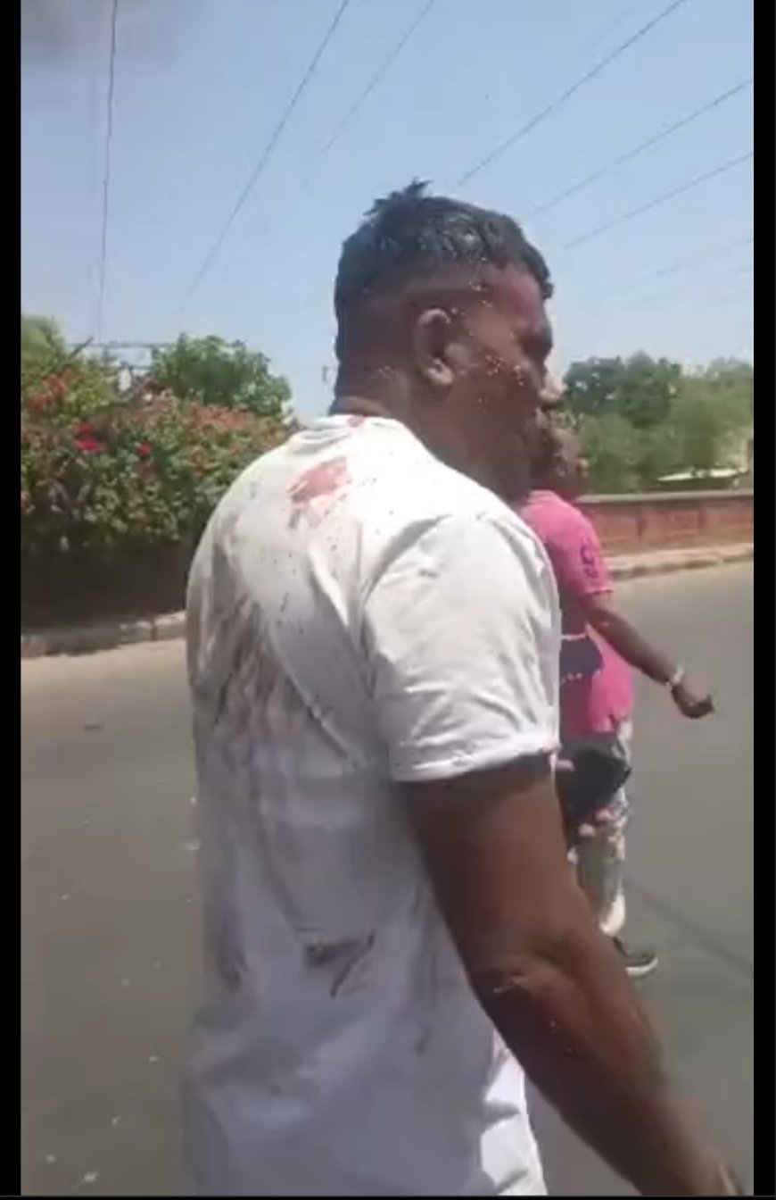 अहमदाबाद विमान हादसा, भारतीय मूल का ब्रिटिश नागरिक जिंदा बचा:बाकी 241 यात्रियों की मौत,